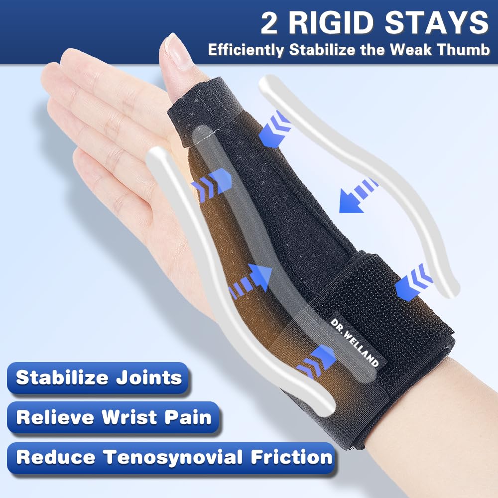 Cutaway showing the two bendable stays that run along each side of the thumb to stabilize the arthritic CMC joint and reduce tendon friction at the wrist.